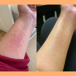 arms of before and after power balm